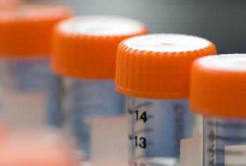 Redução dos  impactos ambientais dos resíduos - Novartis